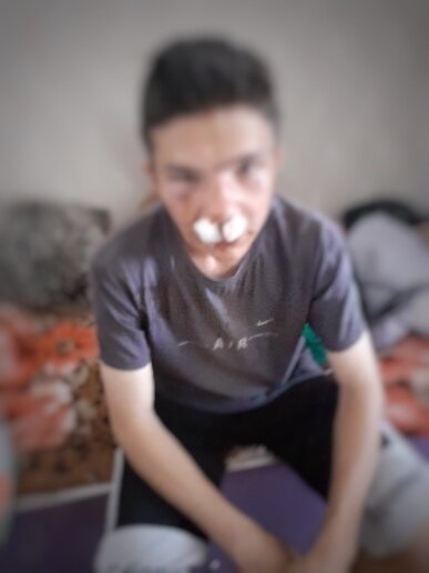 Фото одного из пострадавших мальчиков