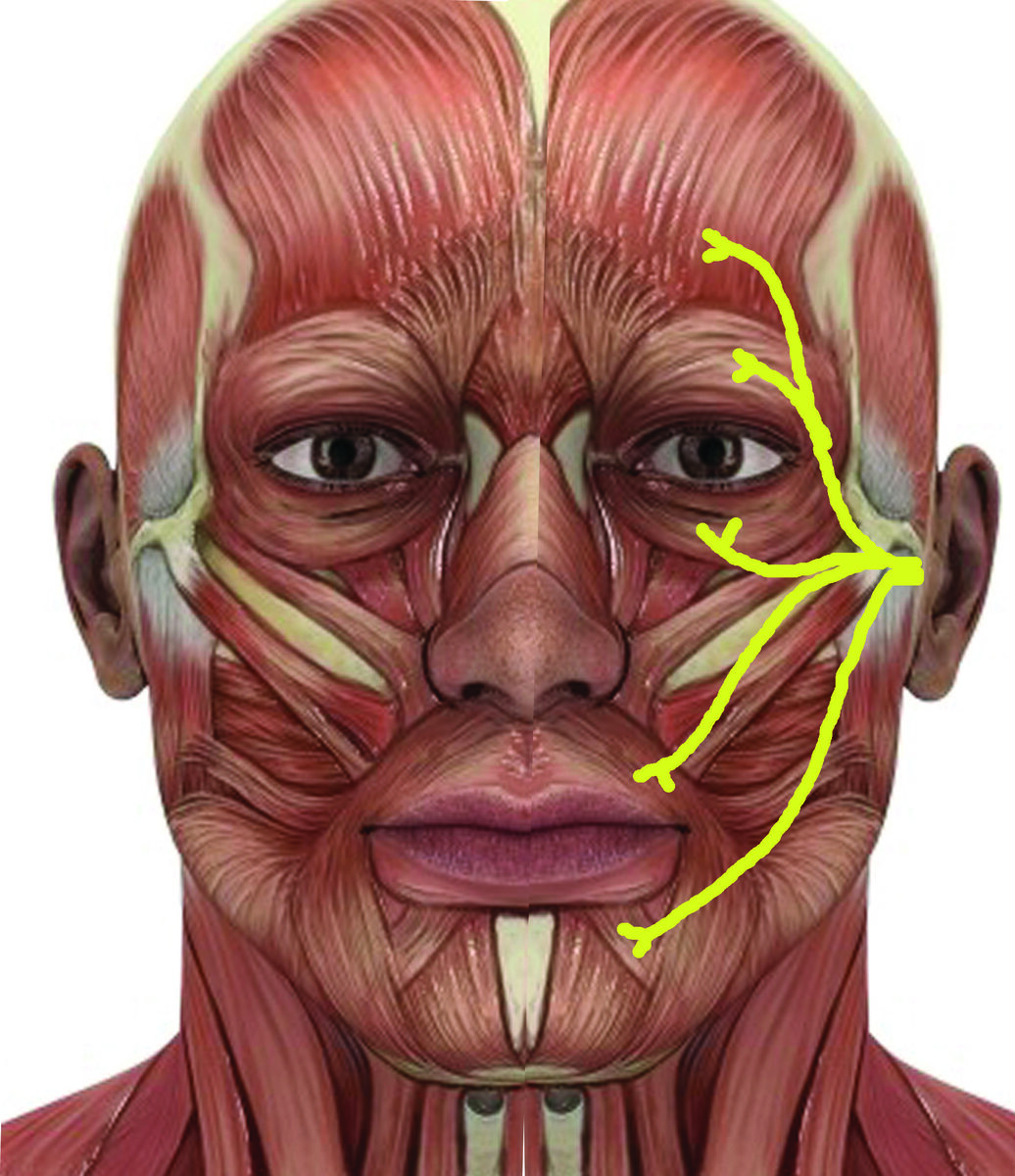 Мышцы лица описание. Мускулюс Фронталис. Мышцы межбровья анатомия. Мимические морщины анатомия. Мышцы лица.
