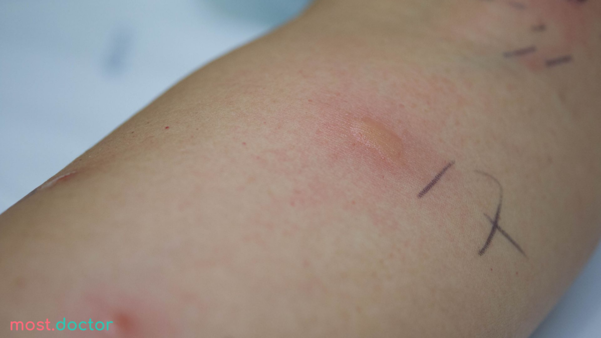 Положительная проба