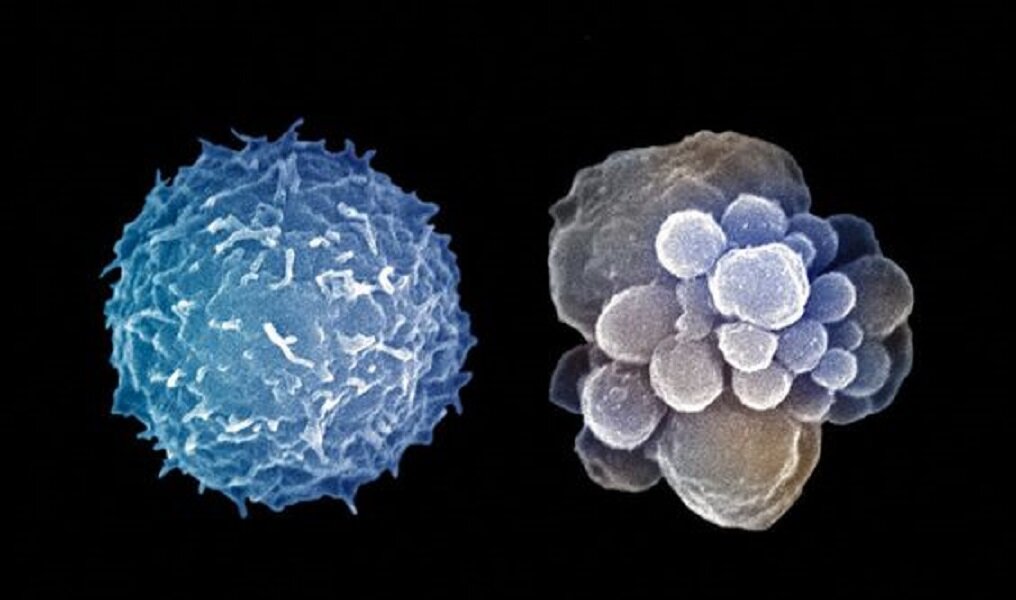 Апоптоз. Источник – https://www.pinterest.ru/pin/658862620470684721/