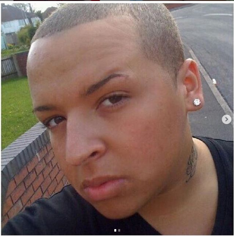 Так Джордан выглядел до операции