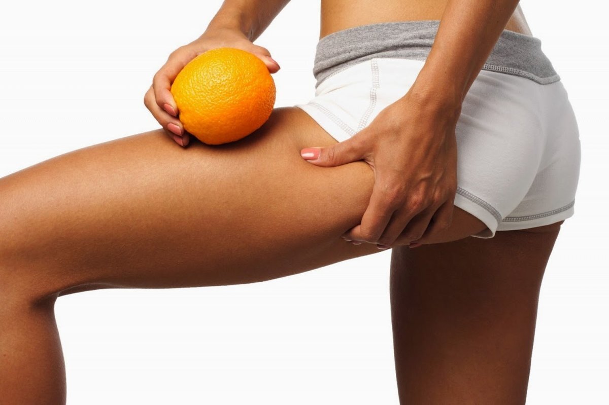 Как избавится от целлюлита