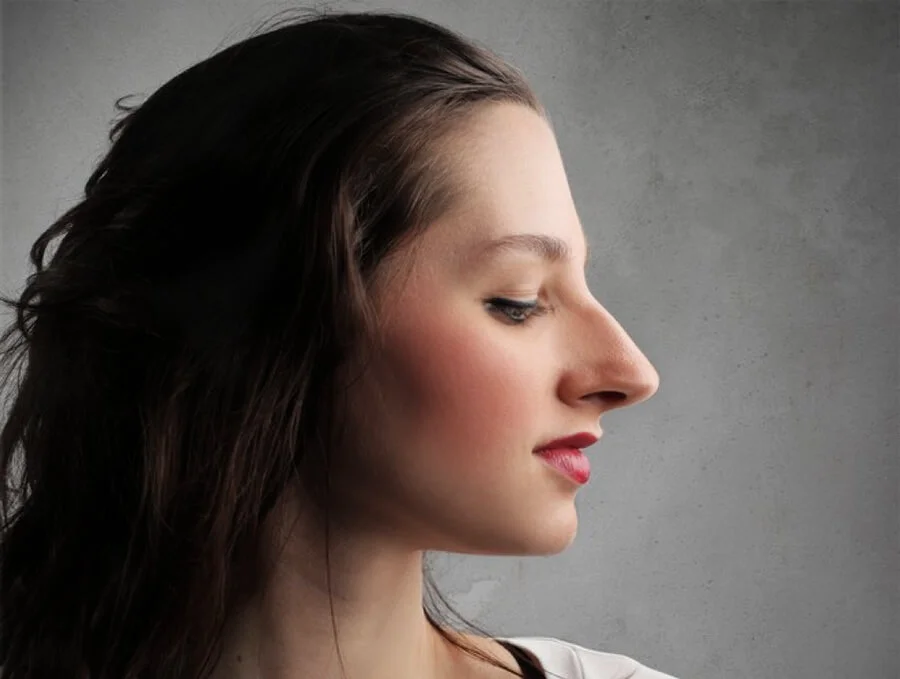 Орлиный нос | Как исправить большой римский нос с горбинкой в «СМ-Пластика»