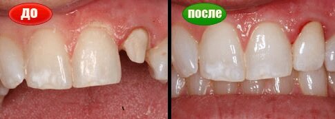 Результат до и после реставрации