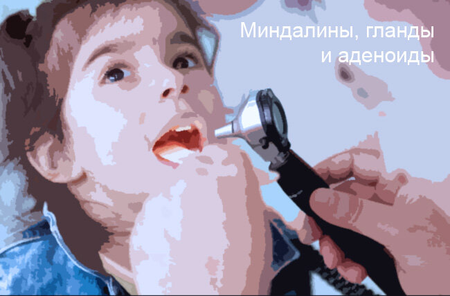 Осмотр миндалин (аденоидов)