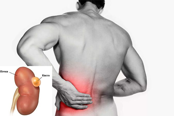 Фото носит иллюстративный характер. Источник фото: Яндекс картинки