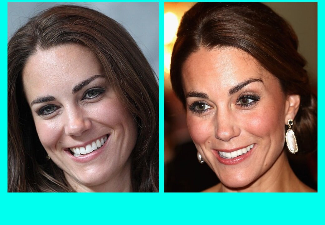 38 летняя Кейт Миддлтон без загара и с загаром