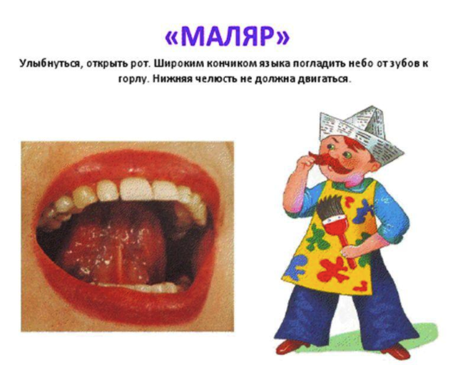 маляр языком. артикуляционная гимнастика матяр. артикуляционная гимнастика маляр. артикуляционная гимнастика мал. маляр языком.