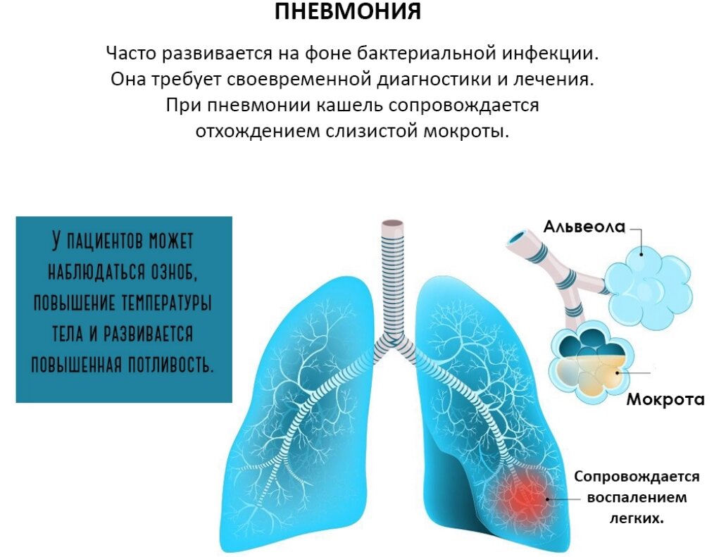 Как отличить бронхит от пневмонии