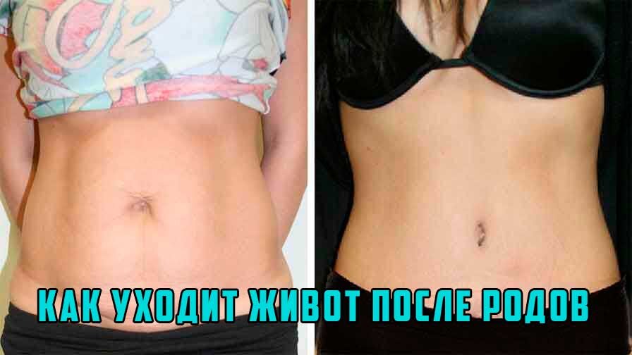 Как и через сколько после родов уходит живот