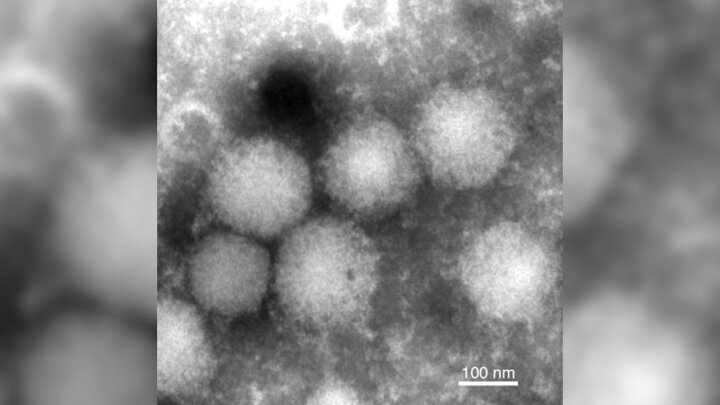 Микрофотография вируса Эдзо. Иллюстрация Fumihiro Kodama et al./Nature Communications, 2021.