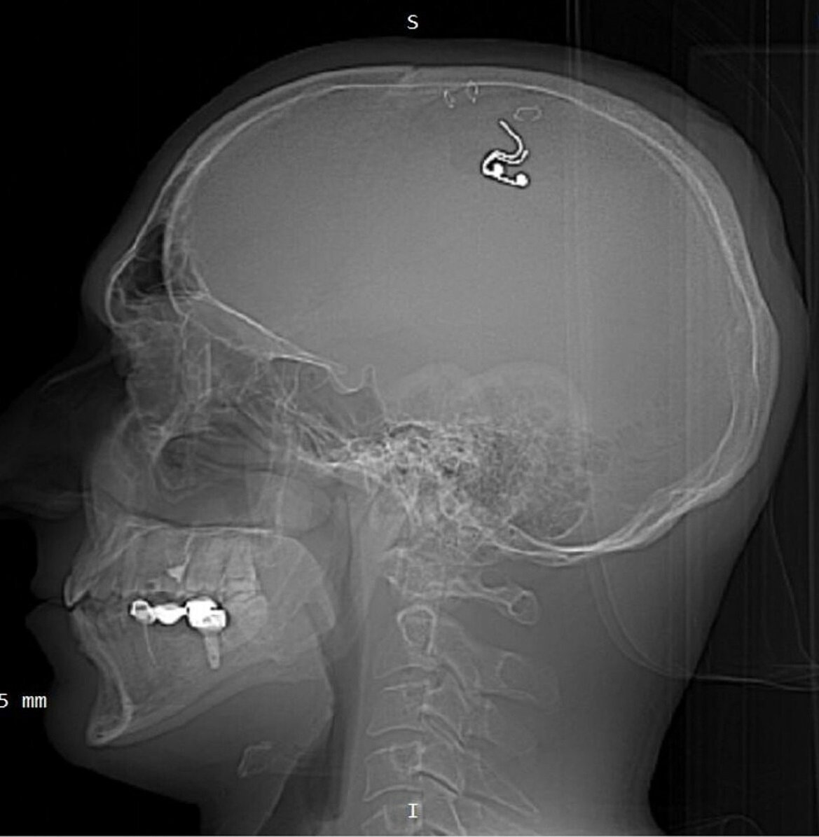 Такой снимок выложил в сеть Михаил. Фото: t.me/misha_raduga 