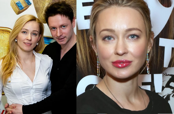 Российские женщины знаменитости, которые увеличили губы и стали выглядеть по-другому