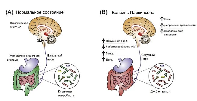 [caption id="attachment_1615" align="aligncenter" width="655"] Работа мозга при недуге[/caption]