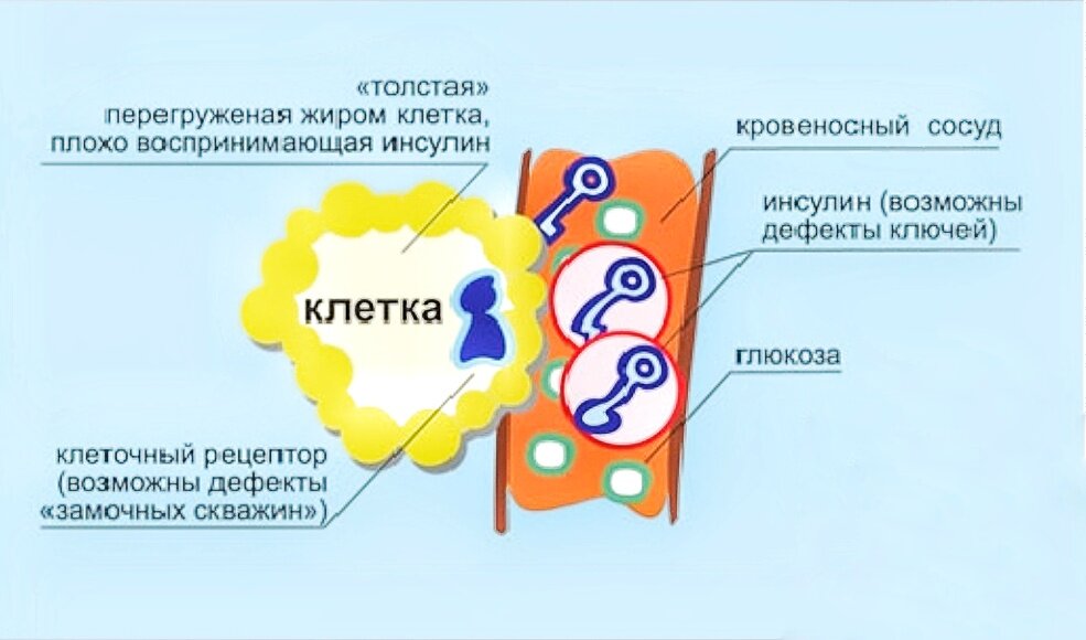 Как получить сахарный диабет 2 типа. Сахарный диабет 2 типа что с клетками. сахарный диабет 1 и 2 типа схема. диабет 1 типа механизм. патогенез сахарного диабета 2 типа ключ замок.