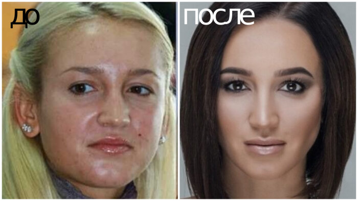 Она изменилась сильно. До и после пластической операции. Люди до и после пластики. Удачные пластические операции. Красивые лица после пластики.