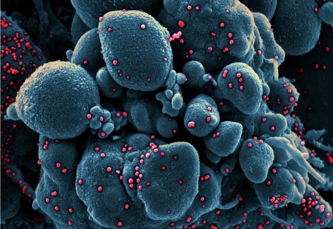 COVID-19 под микроскопом