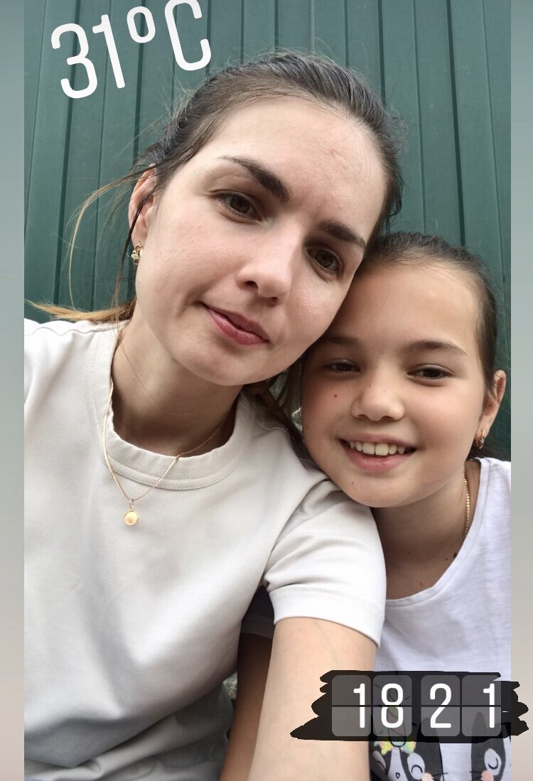 Фото 7 недель пользования косметикой EUCERIN