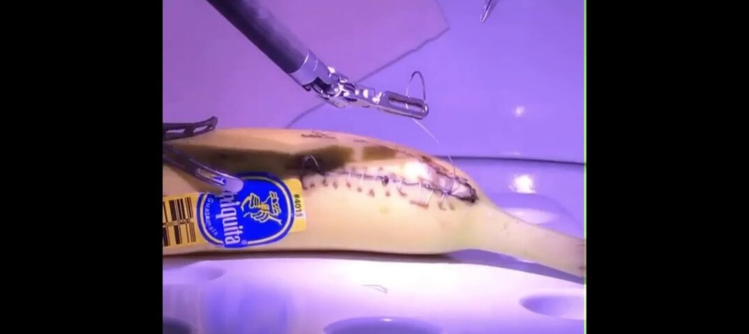 Кадр из видео операция на банане