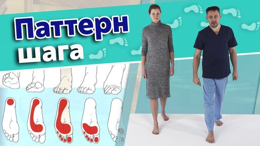 Почему ноги ходят по-разному? Как проверить свой паттерн шага?