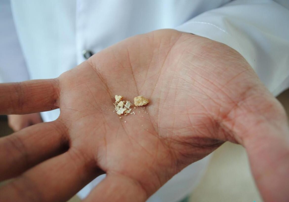 Взято из Яндекс.Картинок