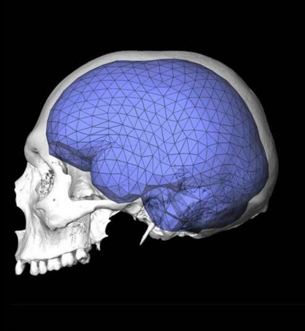 Шаровидная форма черепа - https://yandex.ru/images/search?from=tabbar&text=глобуляризация%20мозга&p=3&pos=117&rpt=simage&img_url=https%3A%2F%2Fi.ytimg.com%2Fvi%2FPM6-fLN3bVw%2Fmaxresdefault.jpg