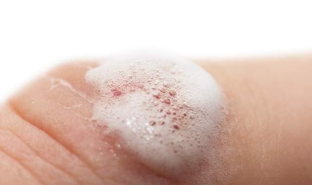 Реакция пернкиси водорода(H202)