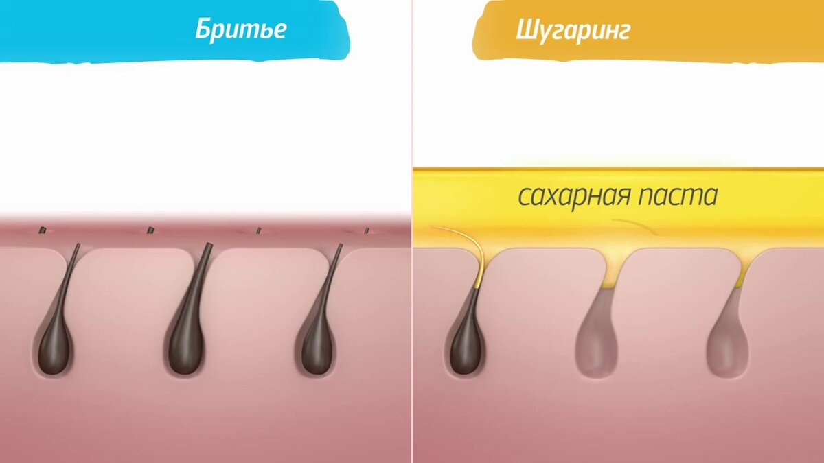 Как побрить зону бикини в домашних условиях