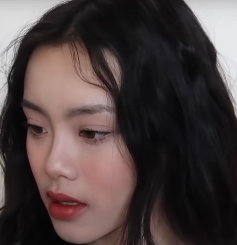 Увеличение губ гиалуроновой кислотой