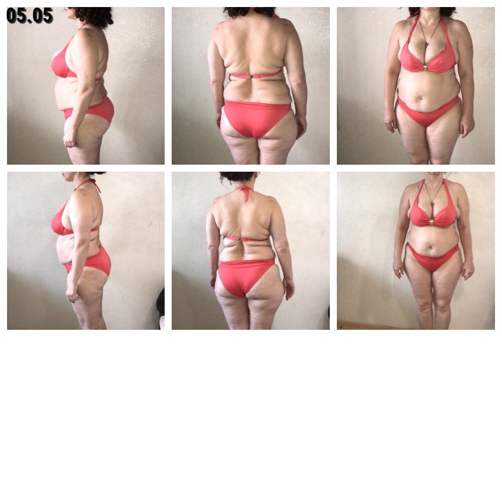 вроде изменения за 2 дня и незаметно.  Впечатление -  немного сдулась. Чуть-чуть и то хорошо))) 