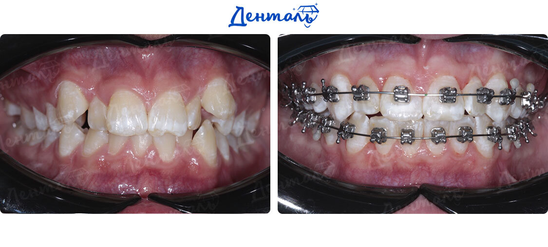 Результаты лечения