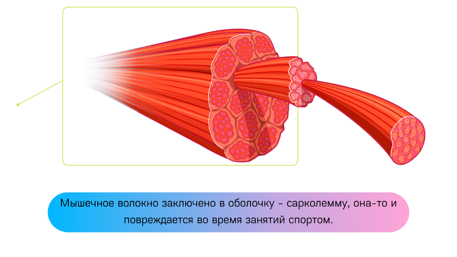 Почему после тренировки болят мышцы