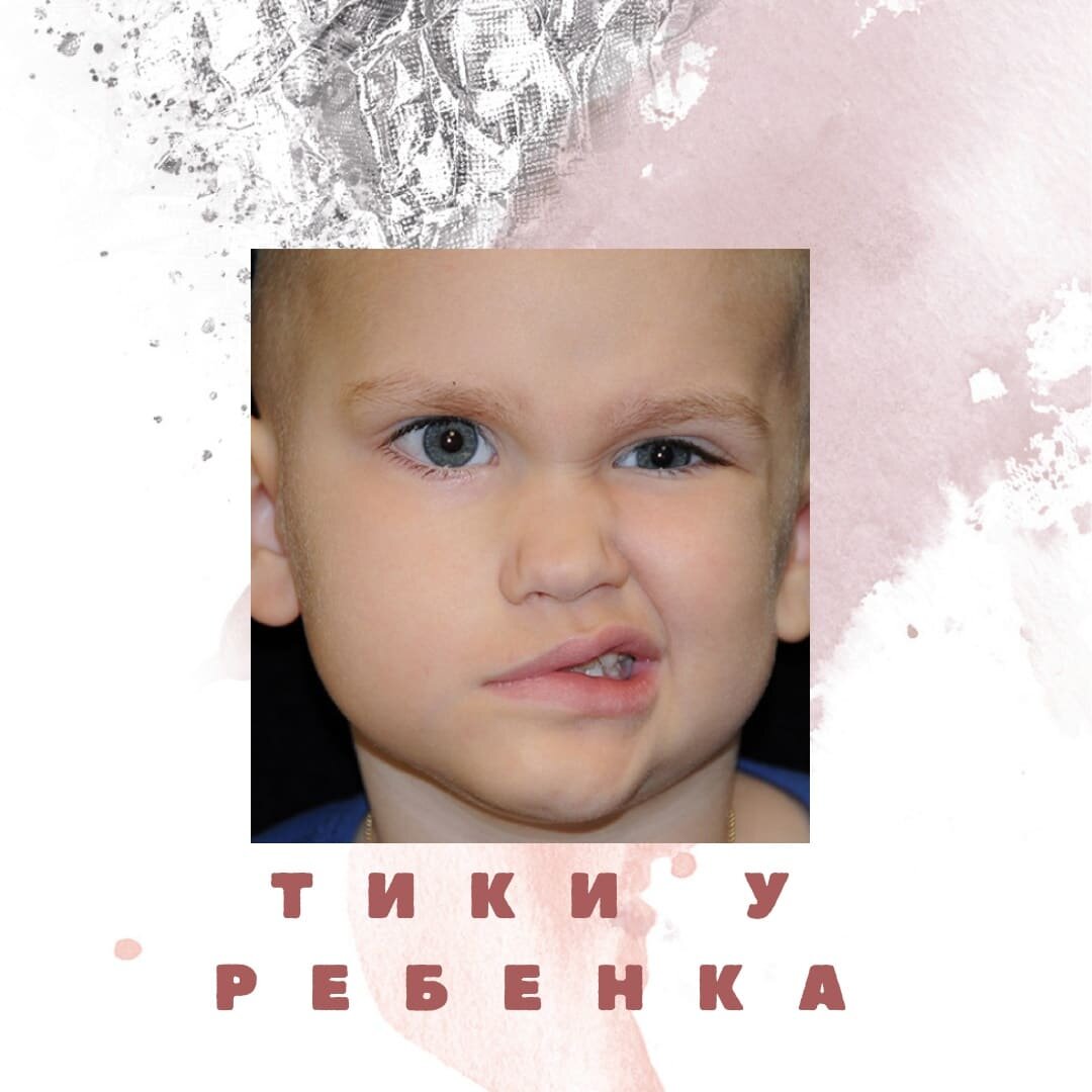 Когда была жуткая нехватка мест в детских садах, то у нас в логопедическую группу добавляли детей без нарушений речи.  Вот в такой группе оказался мальчик, у которого я заметила зажмуривание глаз. Не так давно у моей дочери была такая проблема, невропатолог  объяснил мне, что это тик, назначил лечение и довольно быстро все прошло. Я по доброте душевной решила поговорить с мамой этого мальчика и посоветовать обратиться к врачу. Семья была своеобразная, а я на тот момент была еще довольно молода. Мама скептически выслушала меня и молча ушла. Через полчаса ко мне пришла заведующая и стала отчитывать, что я лезу не в свои дела, ребенок не из логопедической группы,  поэтому я не должна была лезть со своими советами. Оказалось, что мамочка нажаловалась на меня.  Долгое время я вообще боялась говорить родителям о проблемах, которые видела у детей.  В итоге, через год у мальчика развились такие тики, что на него страшно было смотреть. Помните юмореску, когда Винокур играл невропатолога?  Я увидела все это  в реальности и, на самом деле, это совсем не смешно. Плюс ко всему ребенок стал жутко заикаться. Он стал необщительным, замкнутым.  С такими проблемами ребенок ушел в школу…
Дорогие родители!  Если Вы заметили, что Ваш ребенок зажмуривает глазки, дергает шеей, пожимает плечами, шмыгает носом и пр., не откладывайте визит к невропатологу.