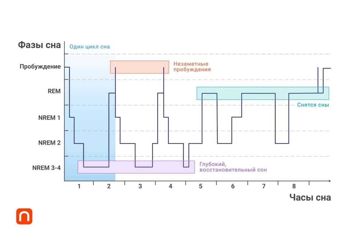 Хронология сна. Фазы сна человека диаграмма. Нормальный график фаз сна. Структура сна фазы медленного и быстрого сна. Фазы сна на графике.