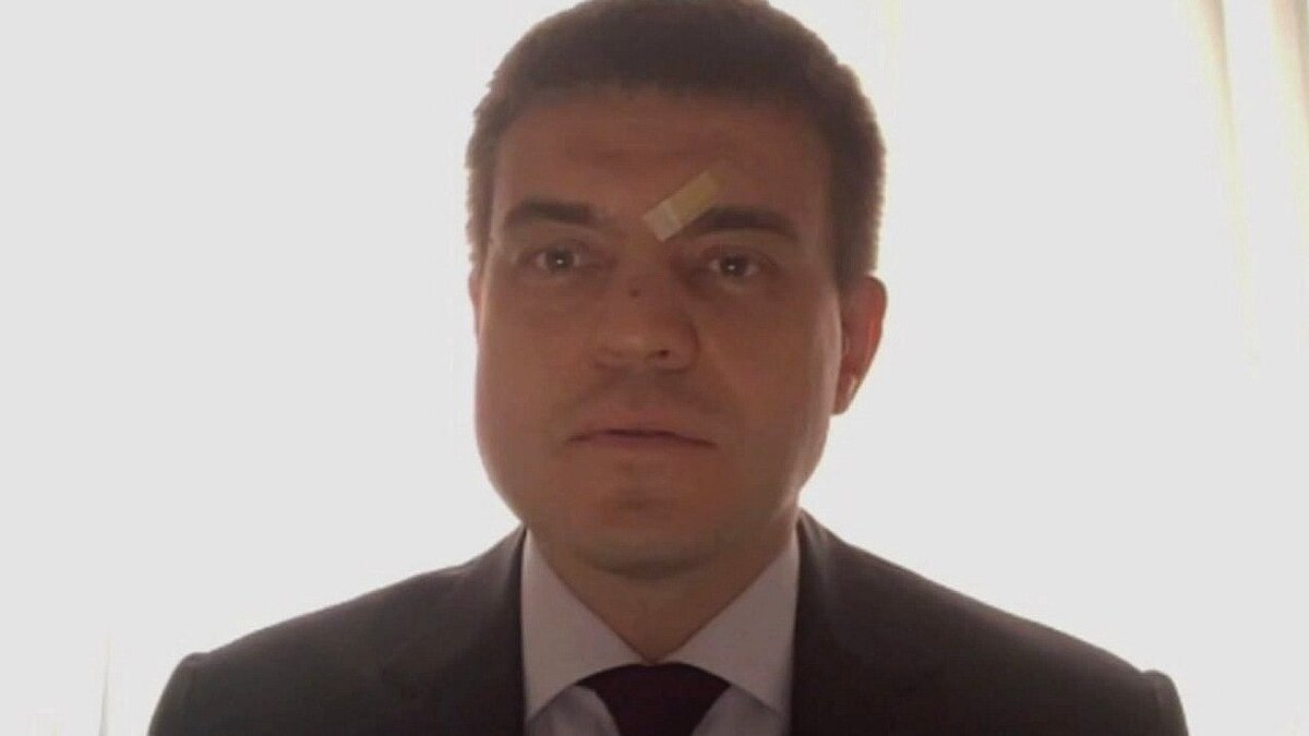     Красноярский телеграм-канал обратил внимание на ссадины на лице врио губернатора Михаила Котюкова — в таком виде он появился, выступая перед педагогами.
