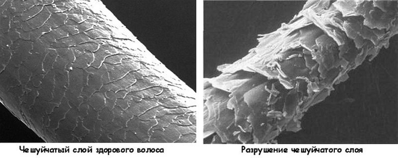 Структура волоса фото