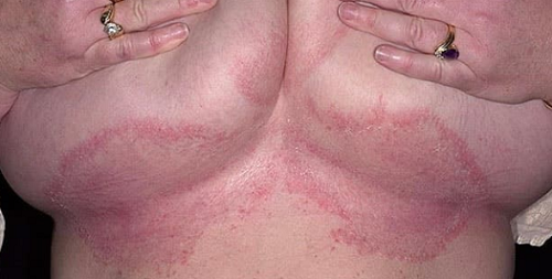 фото: https://ginekolog.guru