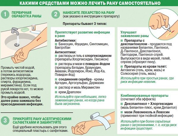 Владимир Попов: При лечении ожогов забудьте про пантенол