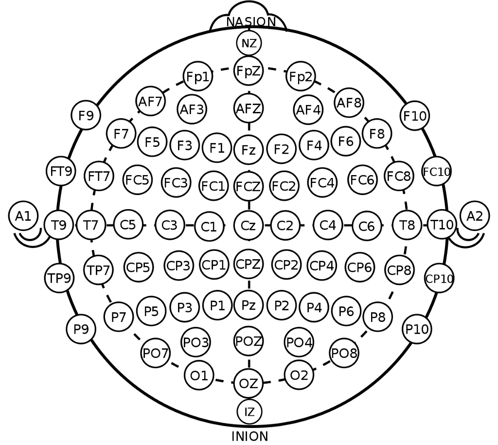 Схема наложения электродов ээг