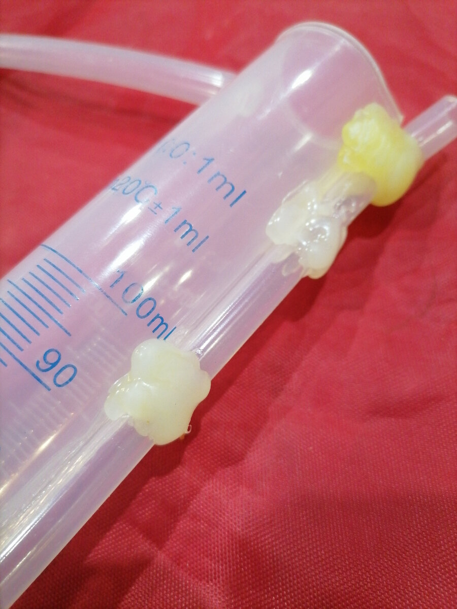 Термоклей смотрится "не айс", а точечно силикон не клеится.