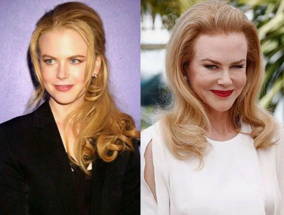 Николь Кидман