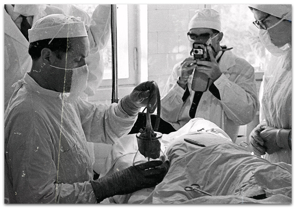 Пересадка сердца, искусственное сердце СССР,  медицинский прорыв