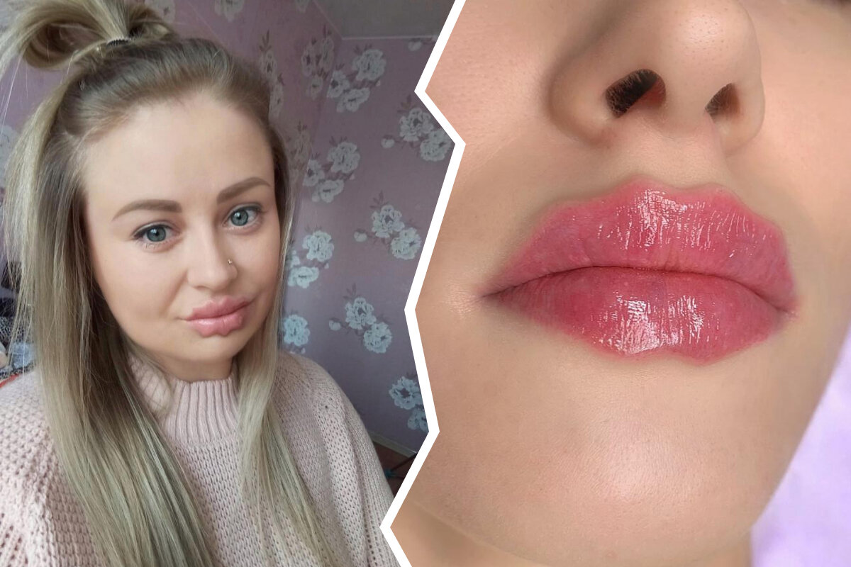 контурная пластика губ отек. красивый татуаж губ. красивая контурная пластика губ. губы новосибирск. накачивание губ новосибирск.