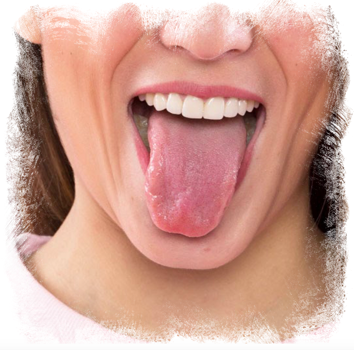 Здоровый язык