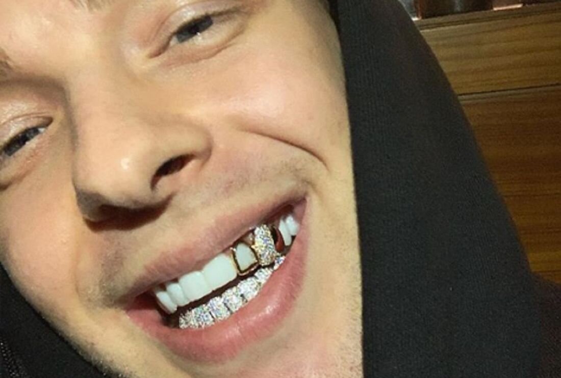 Это гриилзы Егора Крида