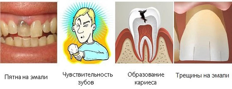 Почему зубы стоят так дорого. Почему зубы стоят так дорого
