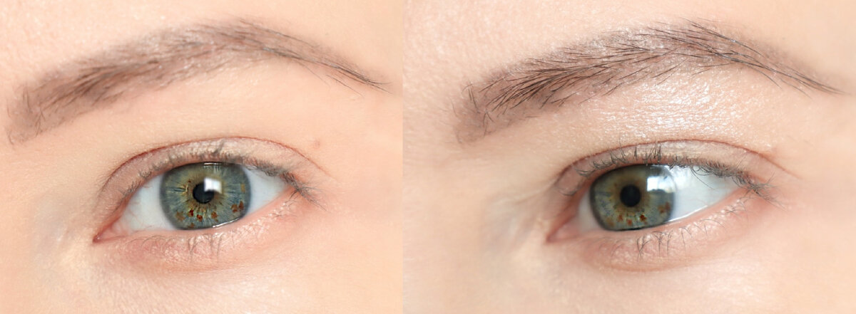 Видно, как даже на самом обычном веке высветление утяжеляет веки, а уж если веки нависают, то этот эффект еще заметнее