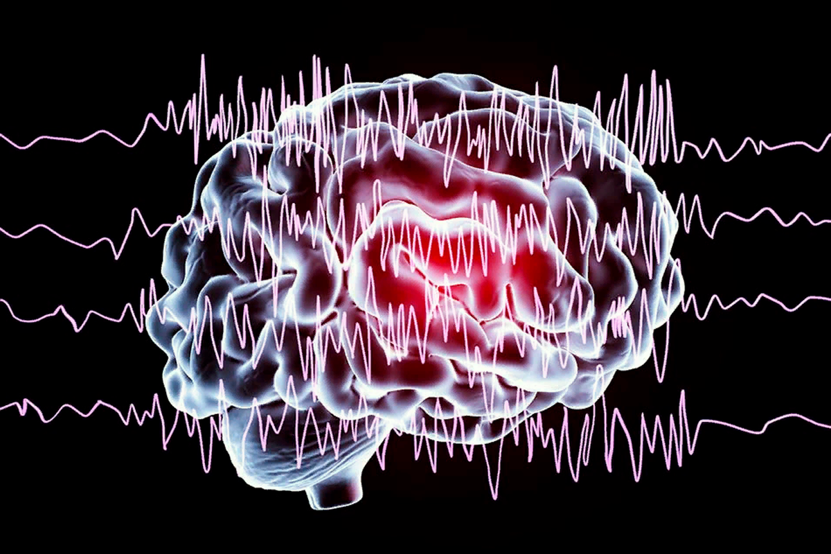 Источник: Яндекс. Картинки.