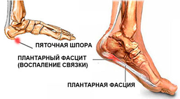 Почему после тренировки болят мышцы. Как унять мышечную боль?