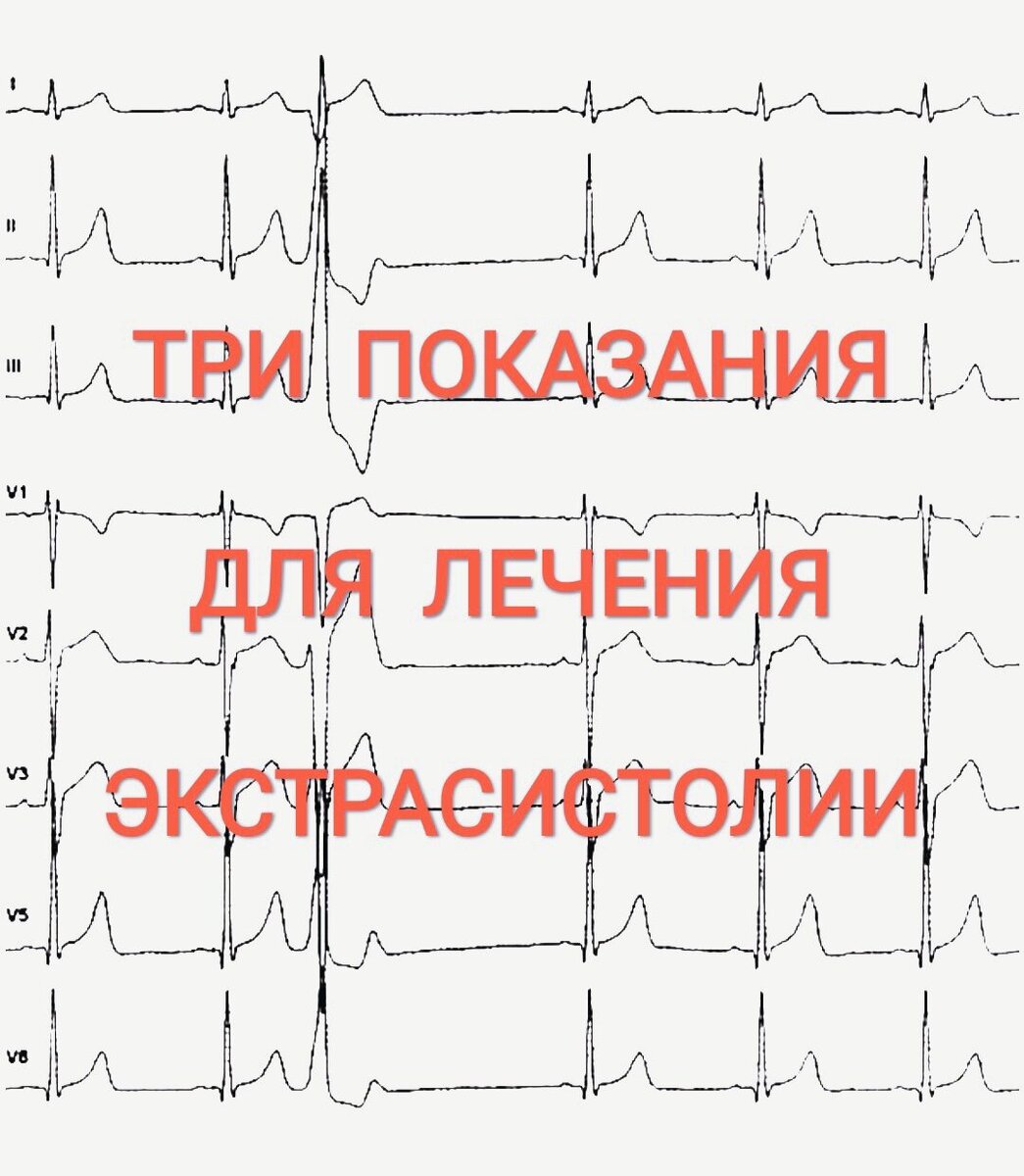 Экстрасистолия: как проявляется и как лечат?